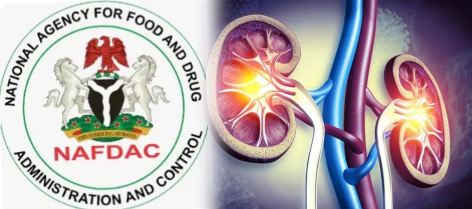 ‎DEATH TOO MANY: NIGERIA MUST ACT AGAINST FAKE DRUGS AND UNSAFE CONSUMABLES – Oluwaseun Ojo